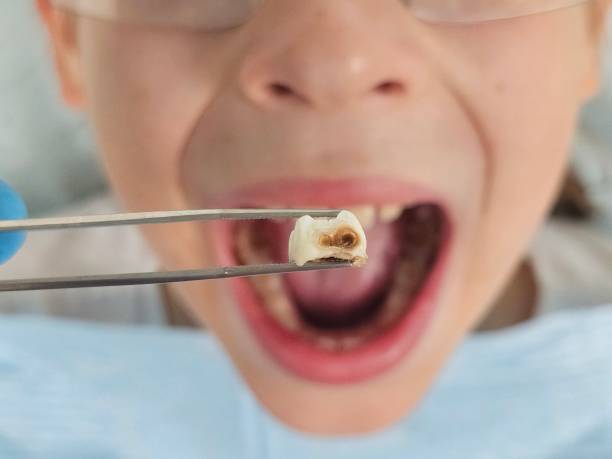 Best Emergency Dental Care for Abscessed Tooth in Byron Center, MI