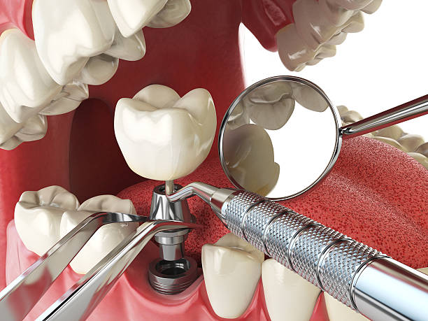 Best Emergency Dental Services for Seniors in Byron Center, MI